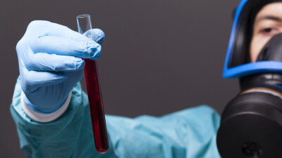 В Алматы выявили случаи заражения британским, южноафриканским и бразильским штаммами Covid-19