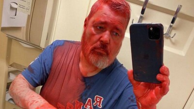 Редактора российской "Новой газеты" Дмитрия Муратова облили краской, у него ожог глаз