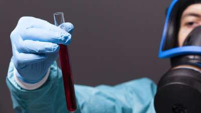 Гвинея объявила о начале эпидемии лихорадки Эбола, умерли три человека