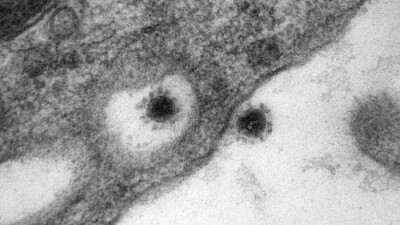 Фото штамма коронавируса Дельта опубликовал российский научный центр