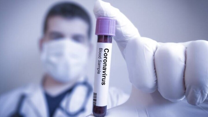Журнал Lancet распустил группу учёных, исследовавшую происхождение Covid-19