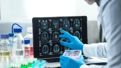 Анализ поставил под сомнение пользу новых препаратов от болезни Альцгеймера