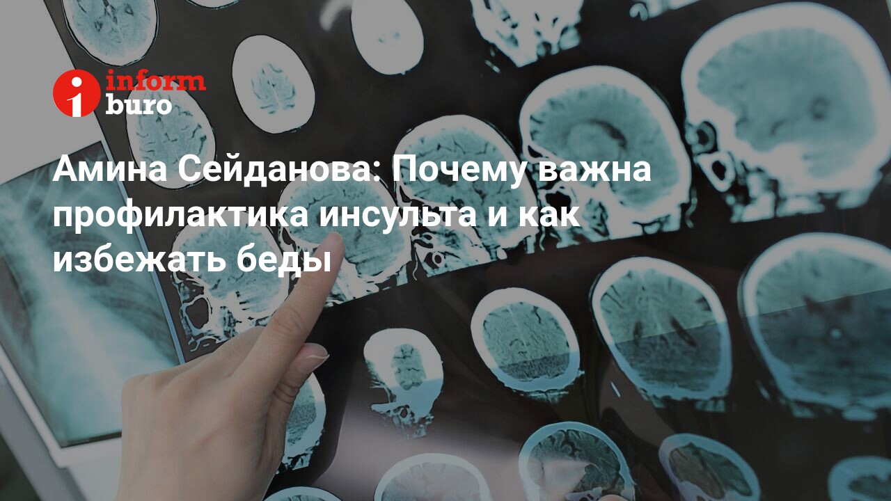 Амина Сейданова: Почему важна профилактика инсульта и как избежать беды |  informburo.kz