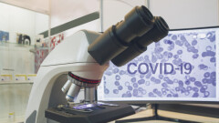 В Казахстане за сутки зарегистрировали 791 случай заражения Covid-19