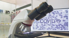 В Казахстане за сутки зарегистрировали 2054 случая заражения Covid-19