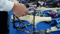 14 уникальных операций провели во время съезда травматологов в Астане