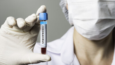 В Казахстане за сутки зарегистрировали 1310 случаев заражения Covid-19, в Алматы больше 400