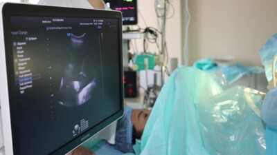 В Астане впервые провели внутриутробную операцию беременной двойней женщине