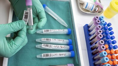 25% бюджета на 1% больных: сколько выделяют в Казахстане на лечение орфанных заболеваний