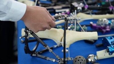 14 уникальных операций провели во время съезда травматологов в Астане