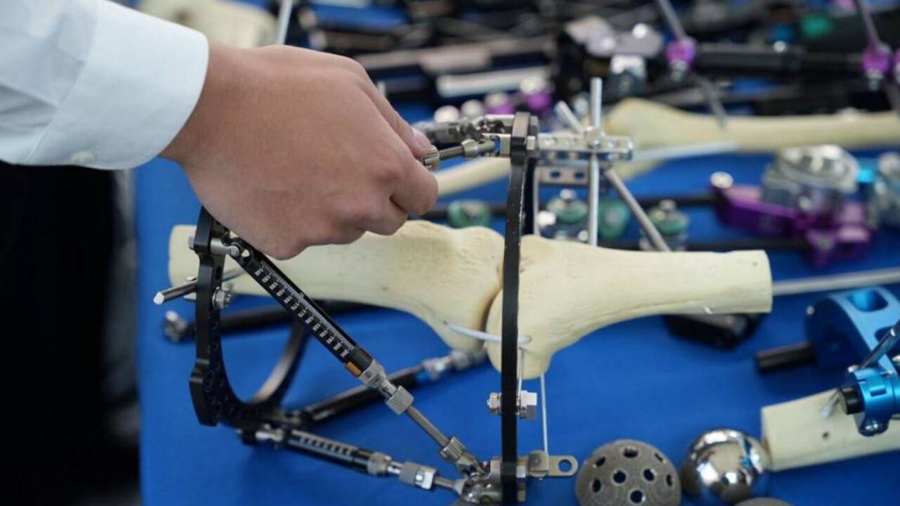 14 уникальных операций провели во время съезда травматологов в Астане