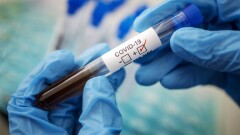 Где в Казахстане снизилась стоимость ПЦР-теста на Covid-19