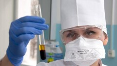 В Казахстане появились специальные тесты для выявления оспы обезьян