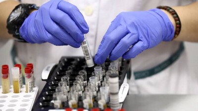 Риск заразиться от вакцинированного больного с КВИ меньше, чем от непривитого