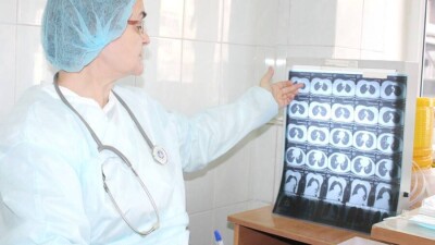 В ВКО в период пандемии выросло число заболевших туберкулёзом