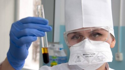 В Казахстане появились специальные тесты для выявления оспы обезьян