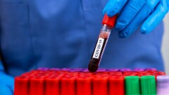 В Казахстане за сутки зарегистрировали 23 случая заражения коронавируcом