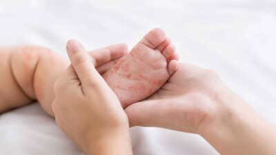 Безапелляционный и неизбирательный вакциноскептицизм имеет уже ощутимые последствия для здоровья детей