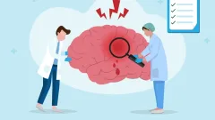 Бір минутта мидың 2 миллионға жуық нейроны өледі. Инсульттің алдын алу жолдары қандай