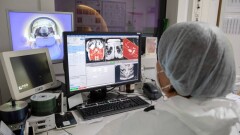 Қазақстанда жылына 600 бала онкологиялық дертке шалдығады