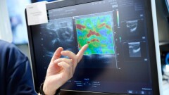 Алаяқтар телемедицина құралдарынан науқастардың жеке мәліметтерін қалай ұрлайды?