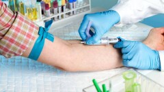 Дәрігерге жазылу, анализ тапсыру секілді амбулаторлық қызметтер бағасы қанша және қай қалаларда арзан?
