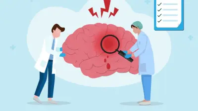 Бір минутта мидың 2 миллионға жуық нейроны өледі. Инсульттің алдын алу жолдары қандай