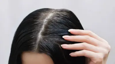 Генетика ма, күйзеліс пе? Трихолог жастардың шашы неге ерте ағарып жатқанын түсіндірді
