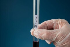 В Казахстане за сутки зарегистрировали 1038 случаев заражения Covid-19