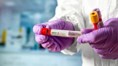 В Казахстане за сутки зарегистрировали 769 случаев заражения Covid-19