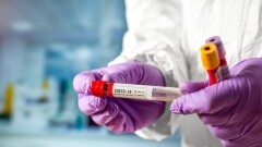 В Казахстане за сутки зарегистрировали 545 случаев заражения Covid-19