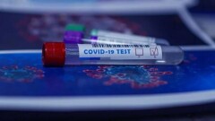 477 случаев заражения Covid-19 зарегистрировали за сутки в Казахстане