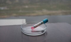 В Казахстане за сутки зарегистрировали 931 случай заражения Covid-19