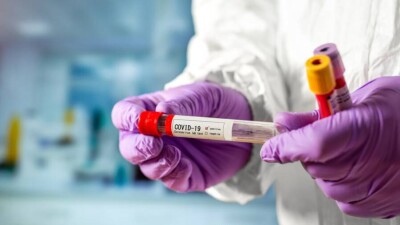 В Казахстане за сутки зарегистрировали 1421 случай заражения Covid-19