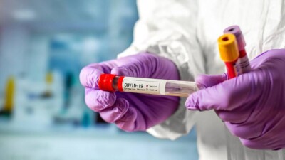 В Казахстане за сутки зарегистрировали 1083 случая заражения Covid-19