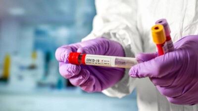 В Казахстане за сутки зарегистрировали 795 случаев заражения Covid-19