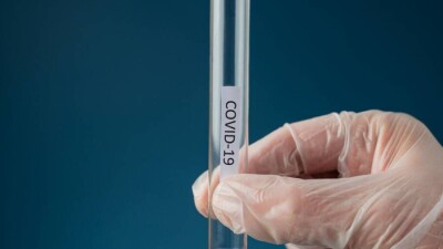 632 случая заражения Covid-19 зарегистрировали за сутки в Казахстане