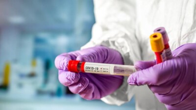 В Казахстане за сутки зарегистрировали 545 случаев заражения Covid-19