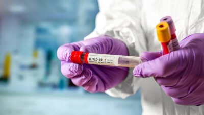 753 случая заражения Covid-19 зарегистрировали за сутки в Казахстане