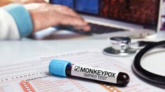 Маймыл шешегіне қарсы вакцина салдыру міндетті бола ма?