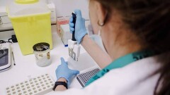Маймыл шешегі пандемияға әкеле ме? Ресей вирусологы баға берді