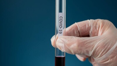 Кипр аралында коронавирустың гибридті нұсқасы – "дельтакрон" анықталды