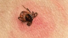 76 астанчан за время майских праздников обратились за помощью из-за укусов клещей