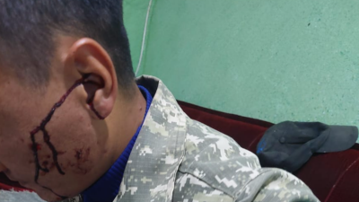 Лесничего избили в Иле-Алатауском нацпарке. Полиция начала расследование 