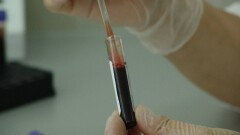 Регионы Казахстана с повышенной смертностью от СПИД назвали в правительстве