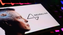 Илон Маск рассказал о втором человеке с имплантом Neuralink