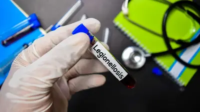 Вспышка легионеллёза в Нью-Йорке: один погиб, 22 человека заболели