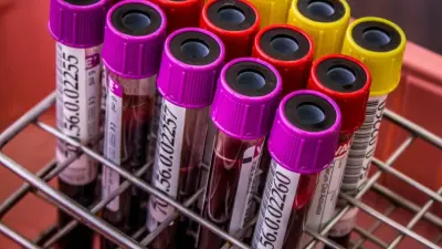 Прокуратура обнародовала результаты тестов знаменитостей Турции по делу о наркотиках