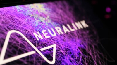 Первый имплантат Neuralink частично отсоединился от мозга пациента. В компании не объяснили причину