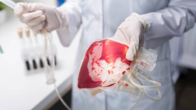 Казахстан и тюркские страны создадут единую информационную систему доноров